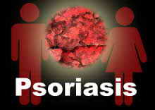 эндогенные факторы псориаза