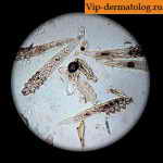 демодекоз фото лечение - клещ под микроскопом