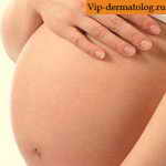крапивница у беременных фото